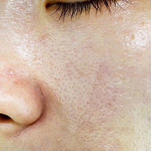 Cleanser